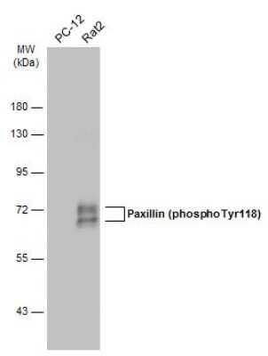 Western Blot: Paxillin [p Tyr118] Antibody [NBP3-13073]